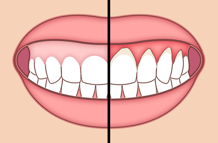 سلامت دندان‌