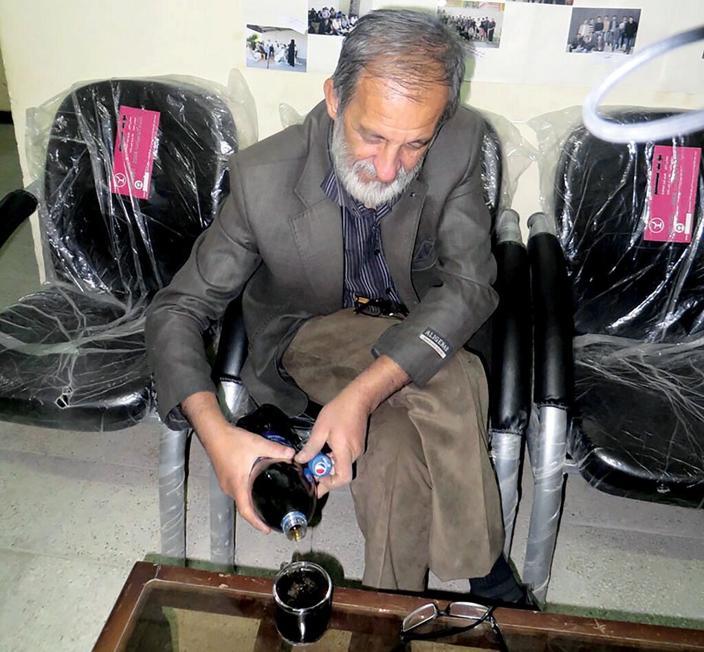 سوختگی با بخار
