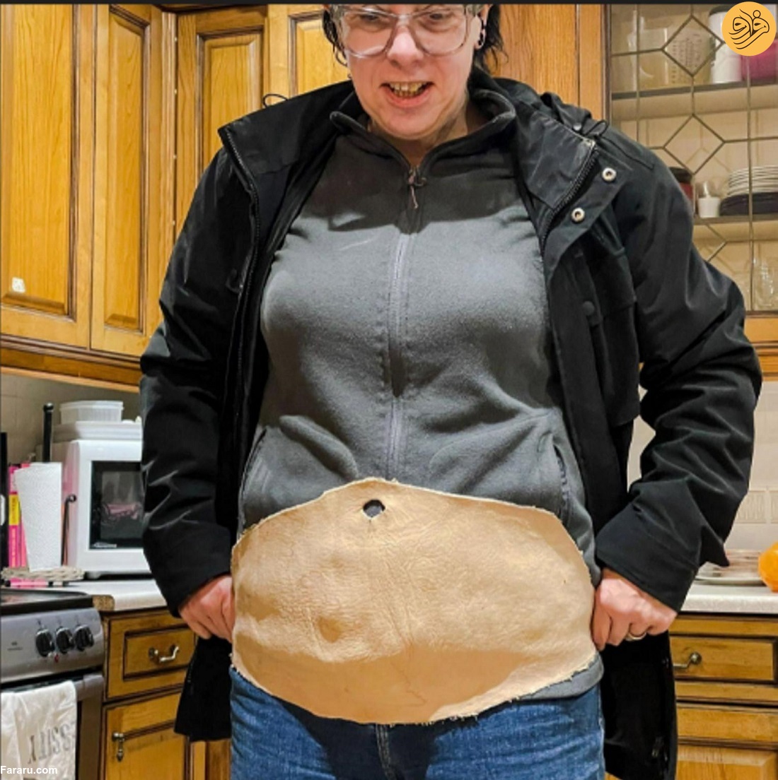 یک زن پوست شکم خود را به چرم انسانی تبدیل کرد! (+عکس)