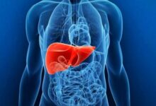 سلامت کبد و صفرا