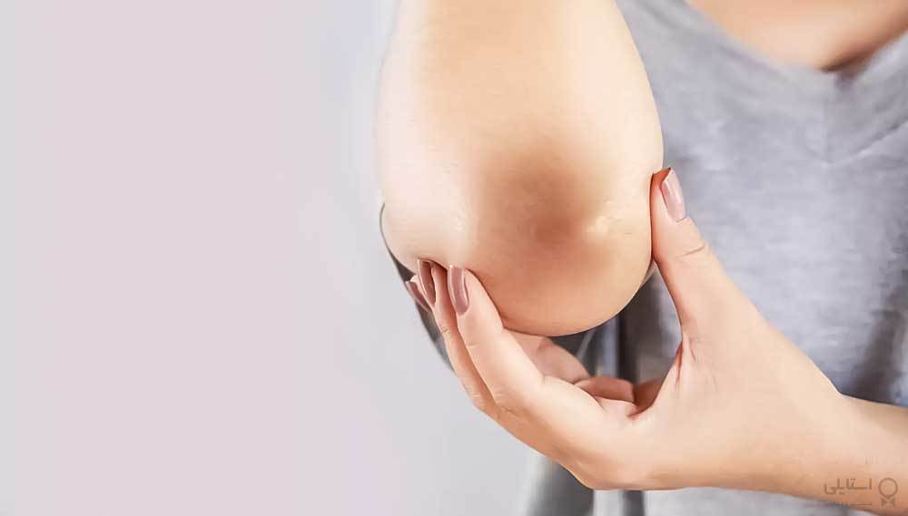 چگونه زانوها و آرنج‌های تیره را روشن کنیم؟