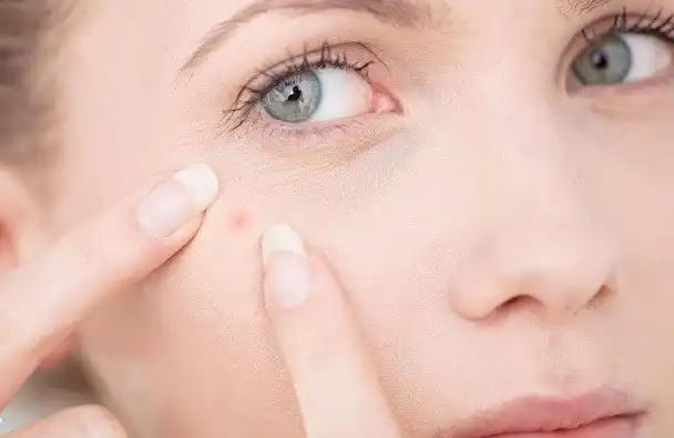 روغن پاپایا