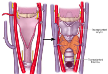 83552c9b c352 4bf3 8a1b 194d3f58512d