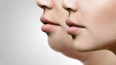 با این حرکات ورزشی ساده از شر غبغب خلاص شو