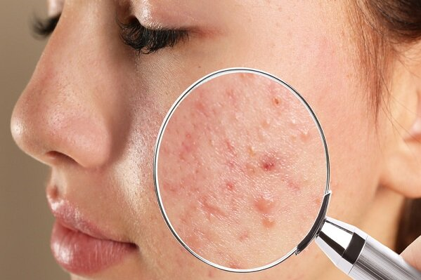 صورتتان درباره سلامتی شما چه می‌گوید؟
