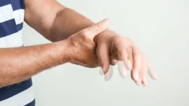 پارکینسون