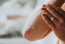 پوست دهیدراته