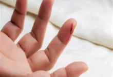 بریدگی‌