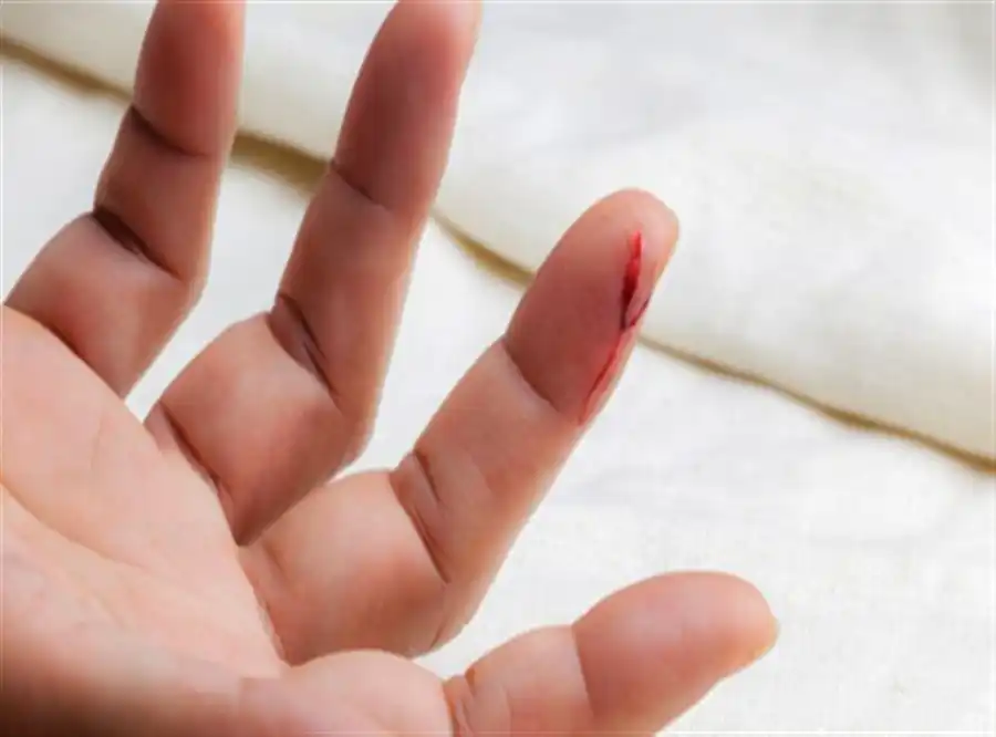 با سوختگی‌ ها و بریدگی‌ ها چه باید کرد؟