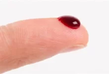 لخته شدن خون