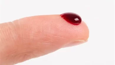 علائم لخته شدن خون را بدانید