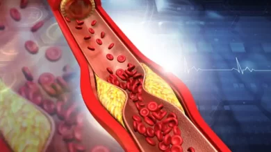 کلسترول خون