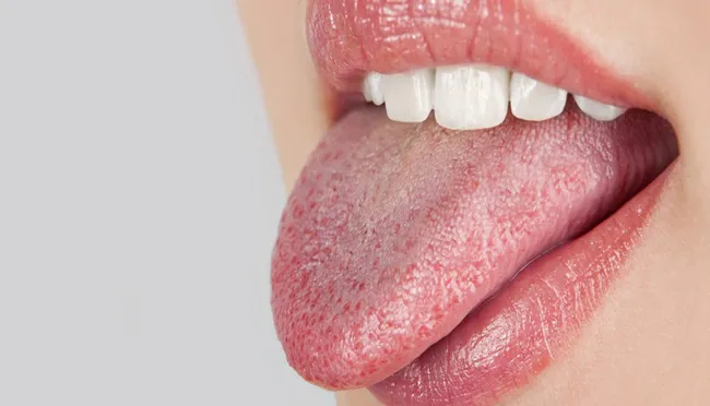 پیشگیری از خشکی دهان در روزه‌داری
