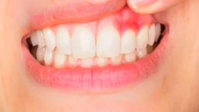 Tooth and gum infection