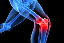 معجون معجزه‌گر