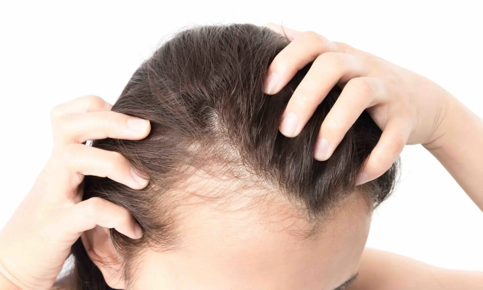 abnormal hair loss 1