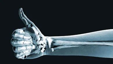 bone strengthening
