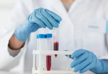 با این آزمایش خون بفهمید که پارکینسون در کمین شماست یا خیر؟