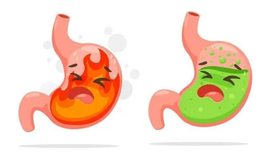 رفلاکس معده