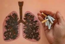 ضرر این خوراکی خوشمزه بیشتر از سیگار است!