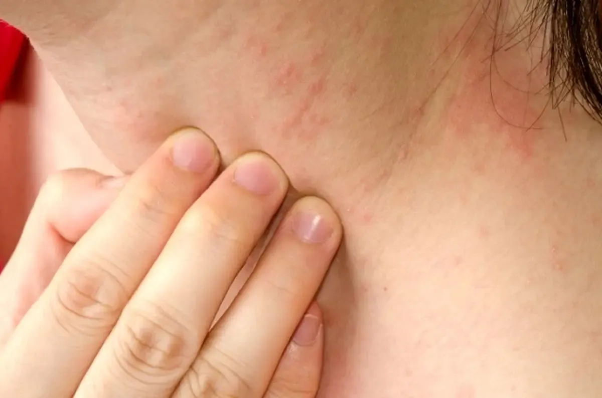 سرطان پانکراس