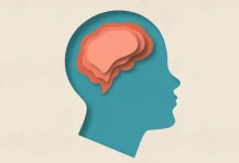 کوچک شدن مغز