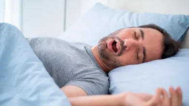 خروپف