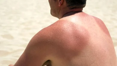 to tan