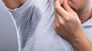 تعریق