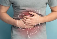 تغذیه مناسب