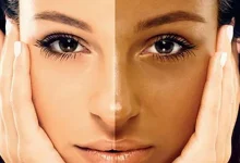 خطر ابتلا به سرطان به علت برنزه کردن پوست