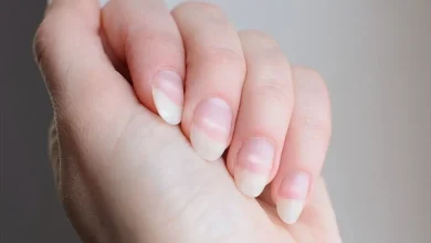 شکل ظاهری ناخن‌ ها خبر از چه بیماری‌ هایی می‌دهند؟