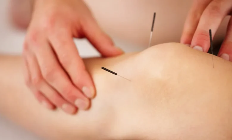 طب سوزنی می تواند عوارض جانبی درمان سرطان سینه را کاهش دهد