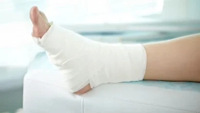 فرمولاسیون جدید برای پانسمان زخم دیابتی3