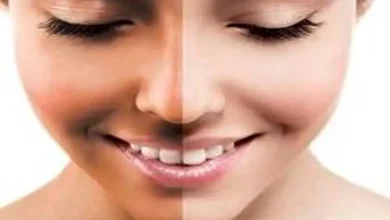 مزایا و عوارض برنزه کردن پوست با سولاریوم چیست؟3