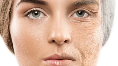 پیری زودرس