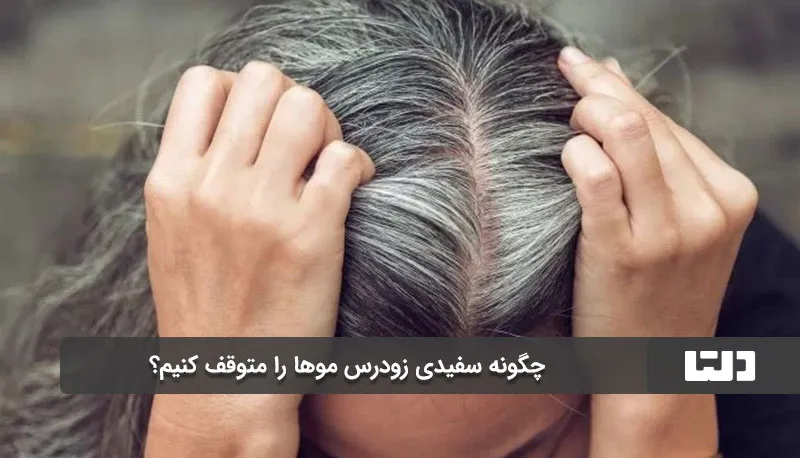 سفیدی زودرس موها