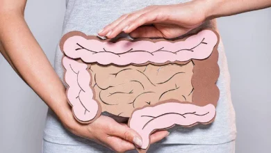 گل