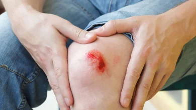 کمبود این 2 ویتامین باعث تاخیر در بهبود زخم‌ها می‌شود2