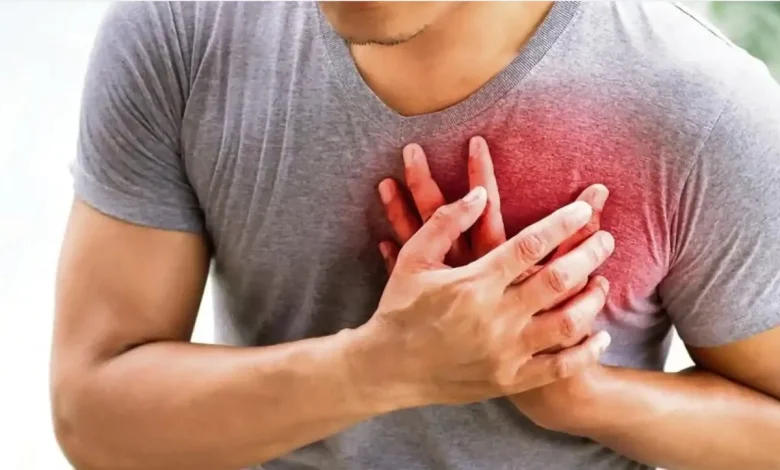 آلزایمر