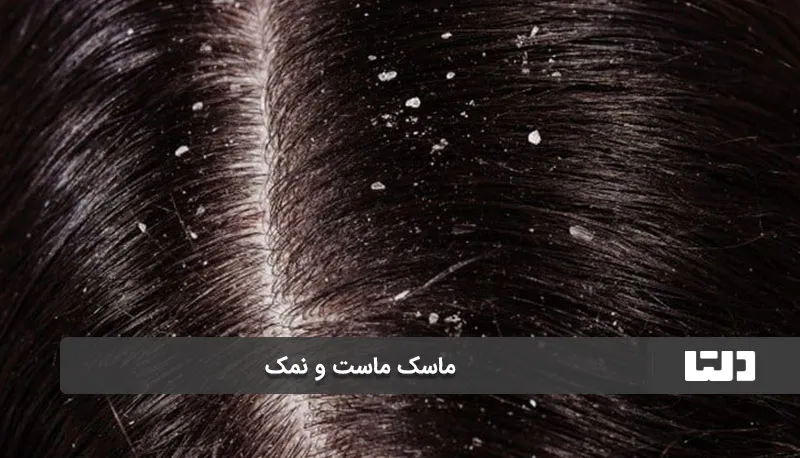 از بین بردن شوره سر با ماست