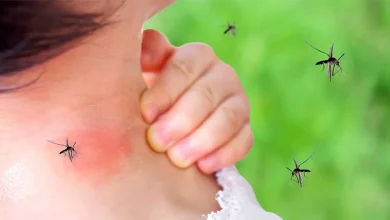 ترفندی خلاقانه برای خلاصی از شر پشه ها