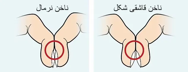 تشخیص سرطان ریه با یک تست ۵ ثانیه ای3