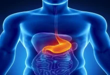 ترش کردن معده