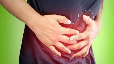سوزش معده را با این ۴ راهکار کاهش دهید