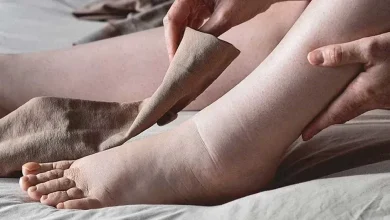علت ورم پا و بررسی راه های درمان آن1