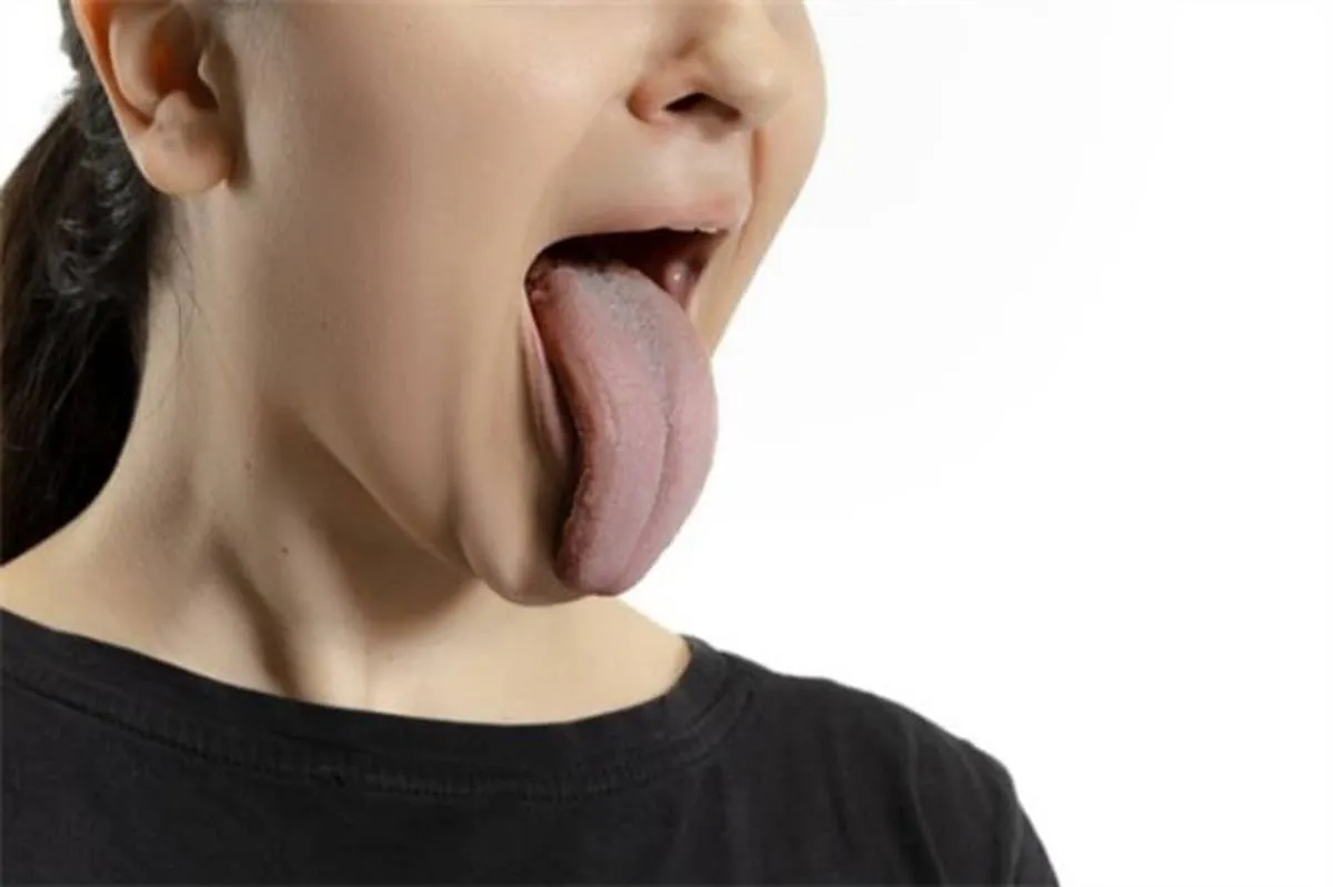 سوسک