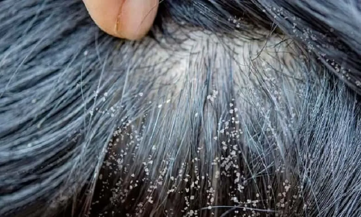 روغن پاپایا