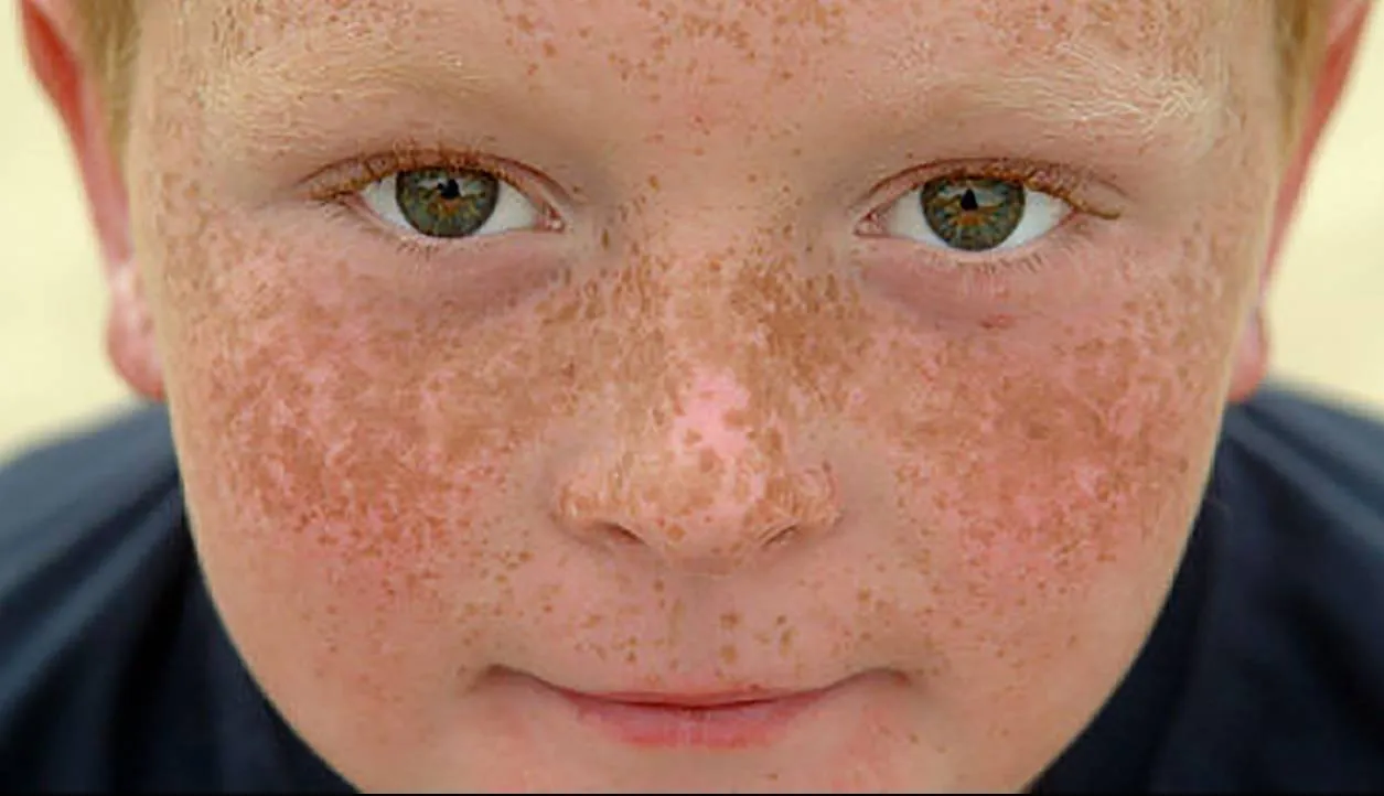 روغن پاپایا