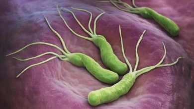 خوراکی‌هایی برای نابودی میکروب معده